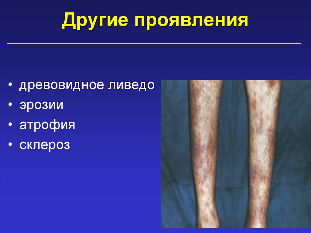 Другие проявления