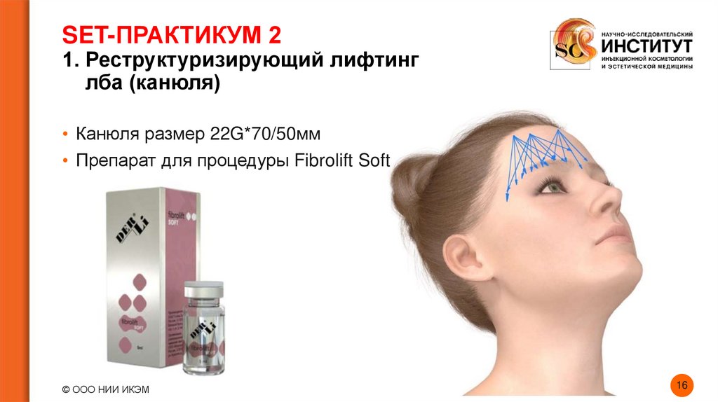 SET-ПРАКТИКУМ 2 1. Реструктуризирующий лифтинг лба (канюля)