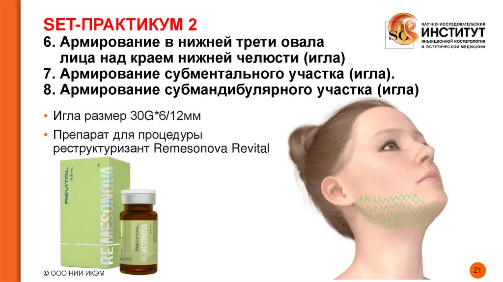 SET-ПРАКТИКУМ 2 6. Армирование в нижней трети овала лица над краем нижней челюсти (игла) 7. Армирование субментального участка