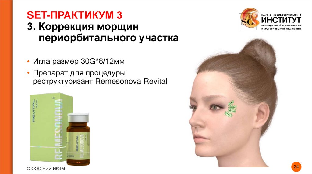 SET-ПРАКТИКУМ 3 3. Коррекция морщин периорбитального участка