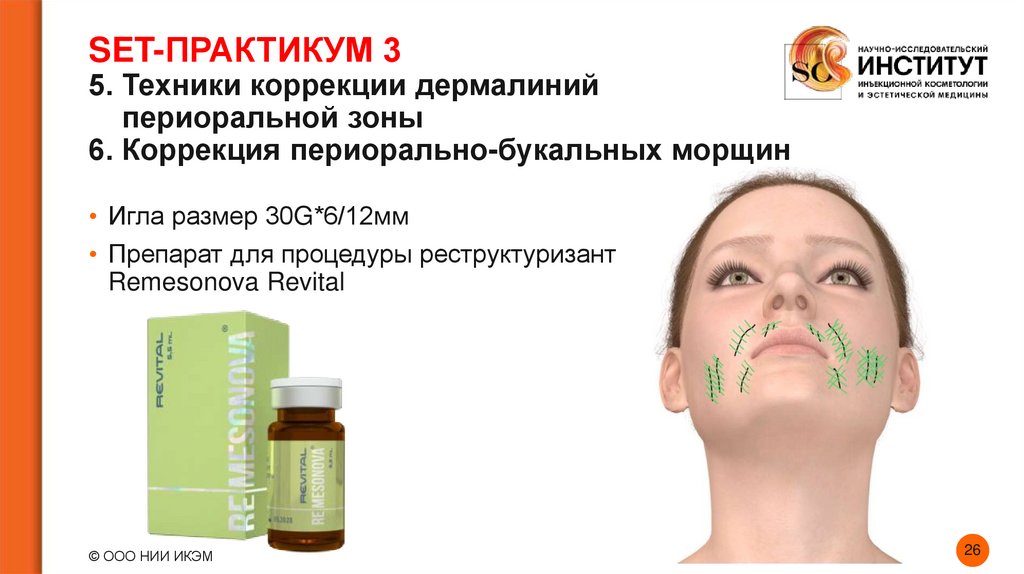 SET-ПРАКТИКУМ 3 5. Техники коррекции дермалиний периоральной зоны 6. Коррекция периорально-букальных морщин