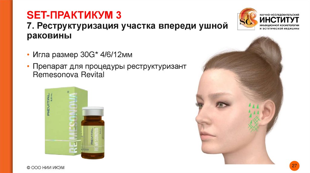 SET-ПРАКТИКУМ 3 7. Реструктуризация участка впереди ушной раковины