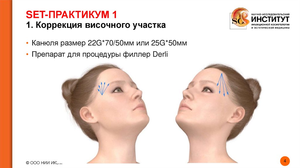 SET-ПРАКТИКУМ 1 1. Коррекция височного участка