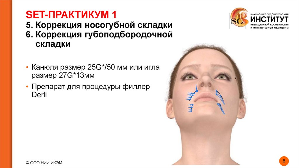 SET-ПРАКТИКУМ 1 5. Коррекция носогубной складки 6. Коррекция губоподбородочной складки