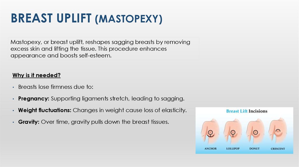 Breast Uplıft (Mastopexy)