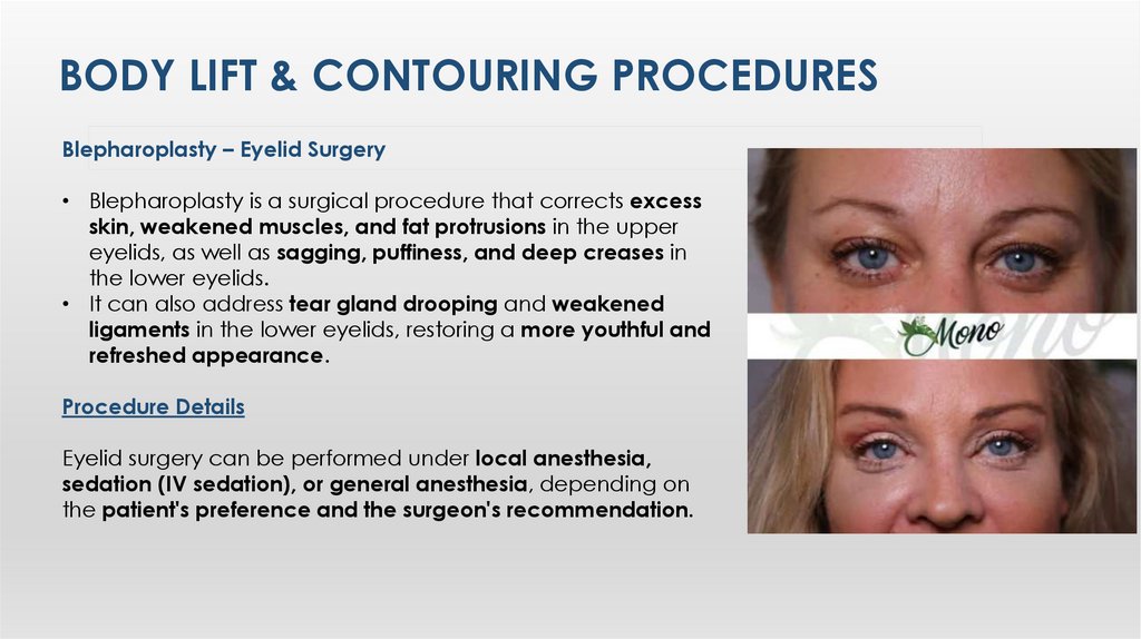 Body LIft & Contourıng Procedures