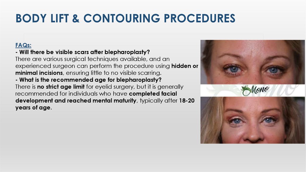 Body LIft & Contourıng Procedures
