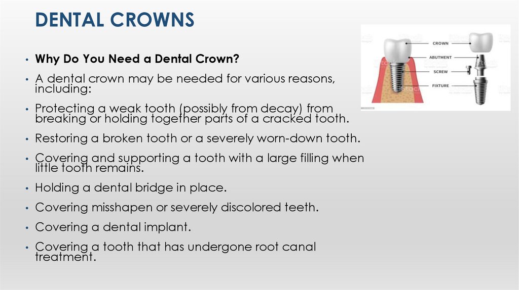 Dental Crowns