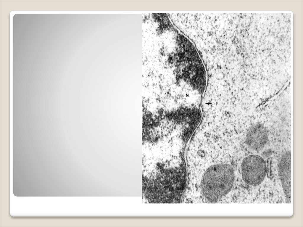 Ядро и ядерные поры х 120 000