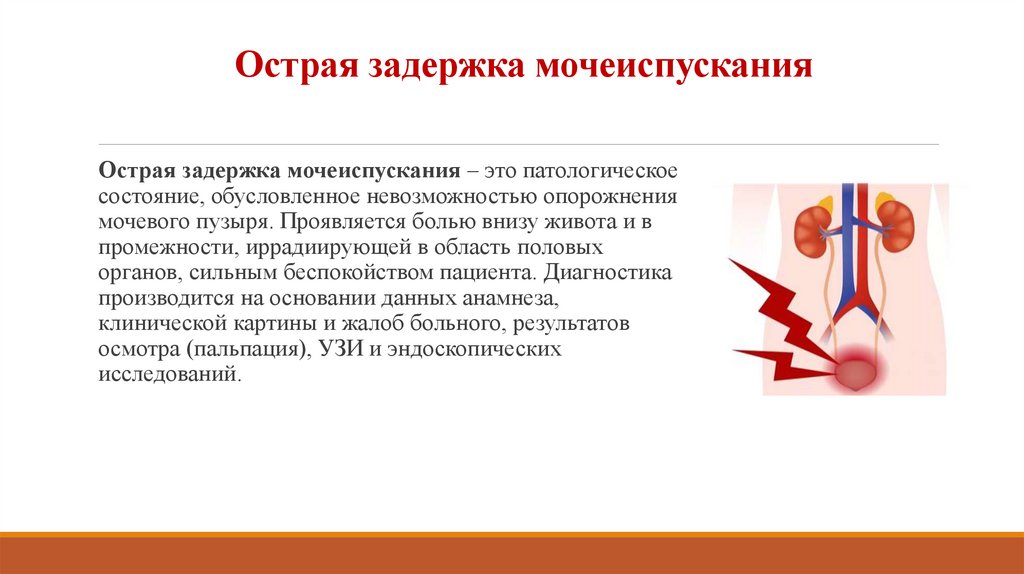 Острая задержка мочеиспускания