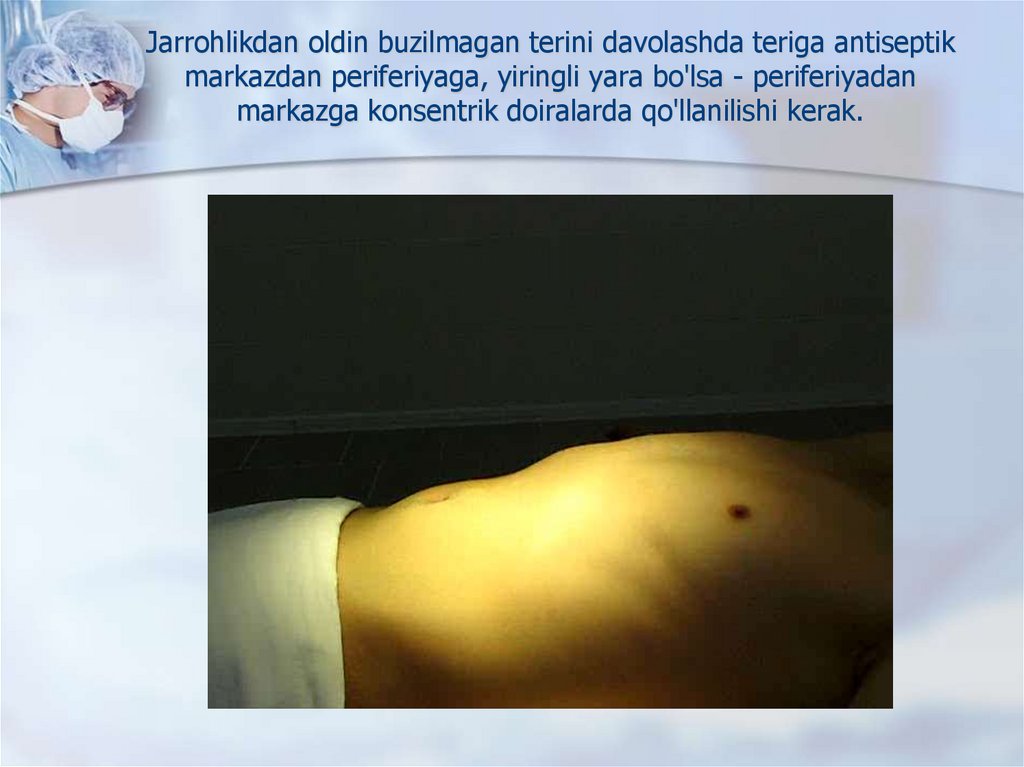 Jarrohlikdan oldin buzilmagan terini davolashda teriga antiseptik markazdan periferiyaga, yiringli yara bo'lsa - periferiyadan