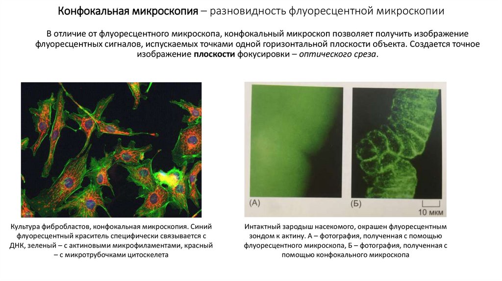 Конфокальная микроскопия – разновидность флуоресцентной микроскопии