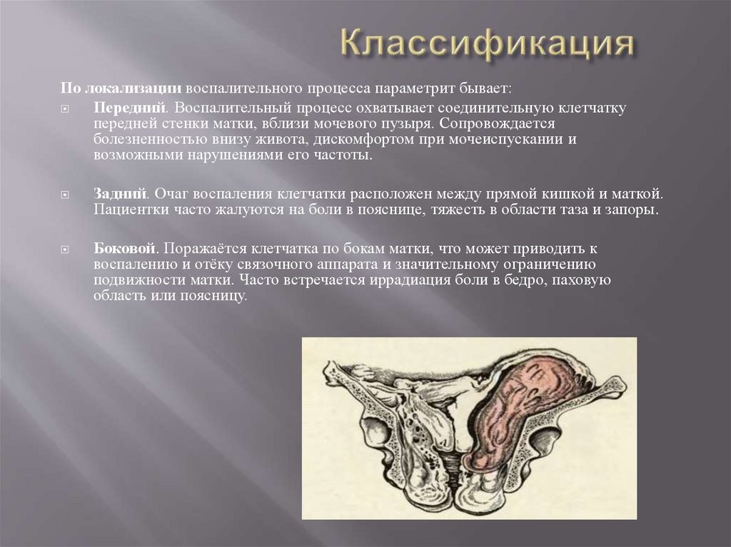 Классификация