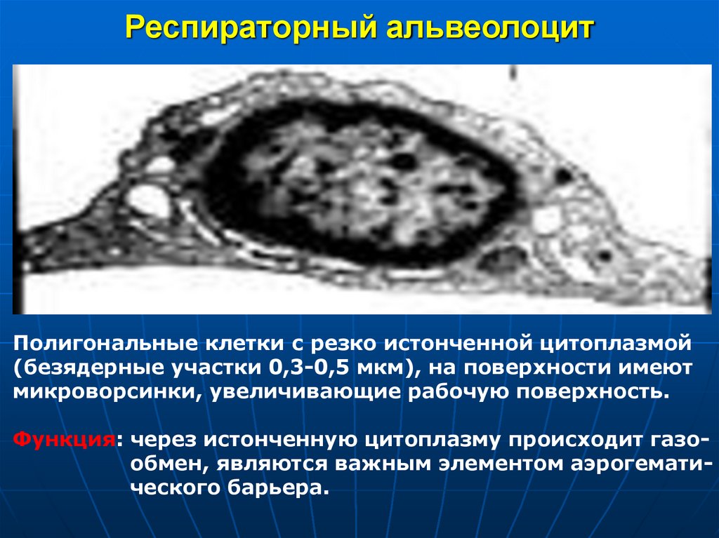 Респираторный альвеолоцит