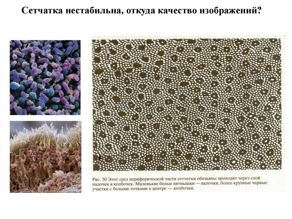 Сетчатка нестабильна, откуда качество изображений?