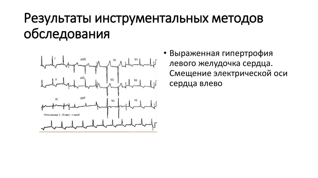 Результаты инструментальных методов обследования