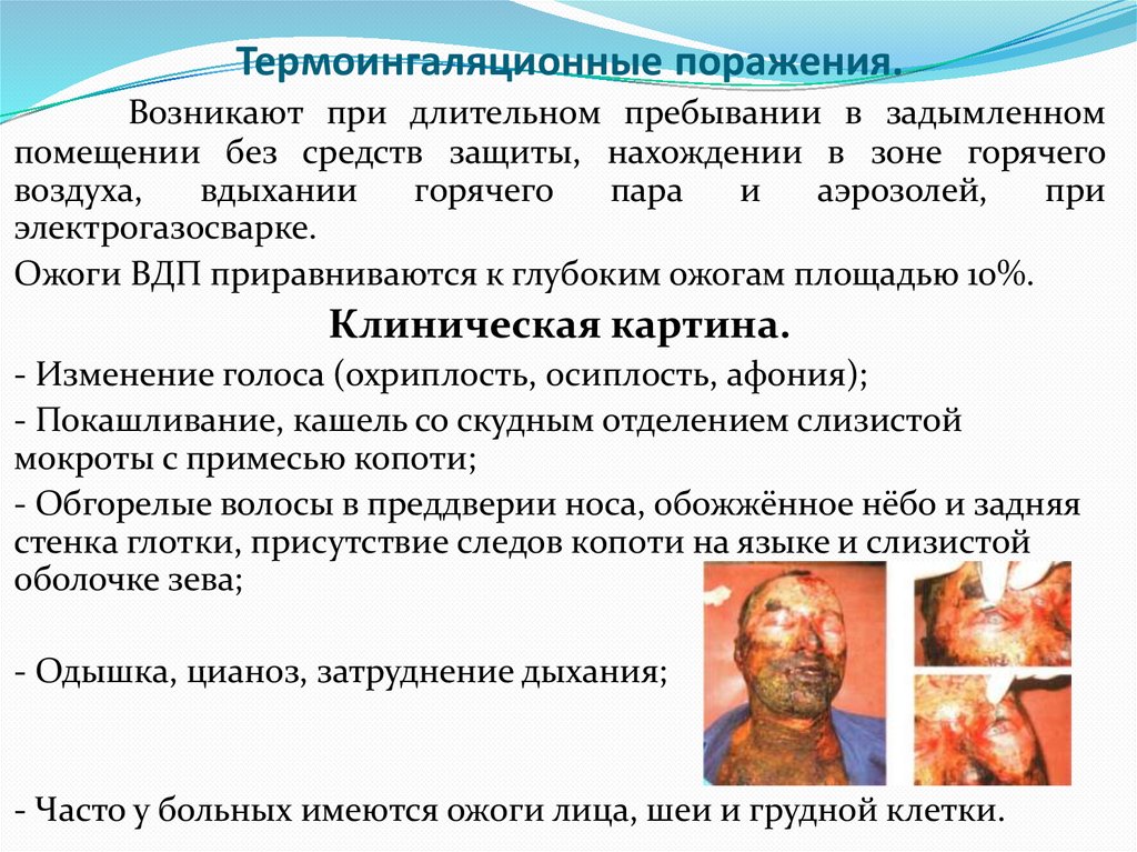 Термоингаляционные поражения.