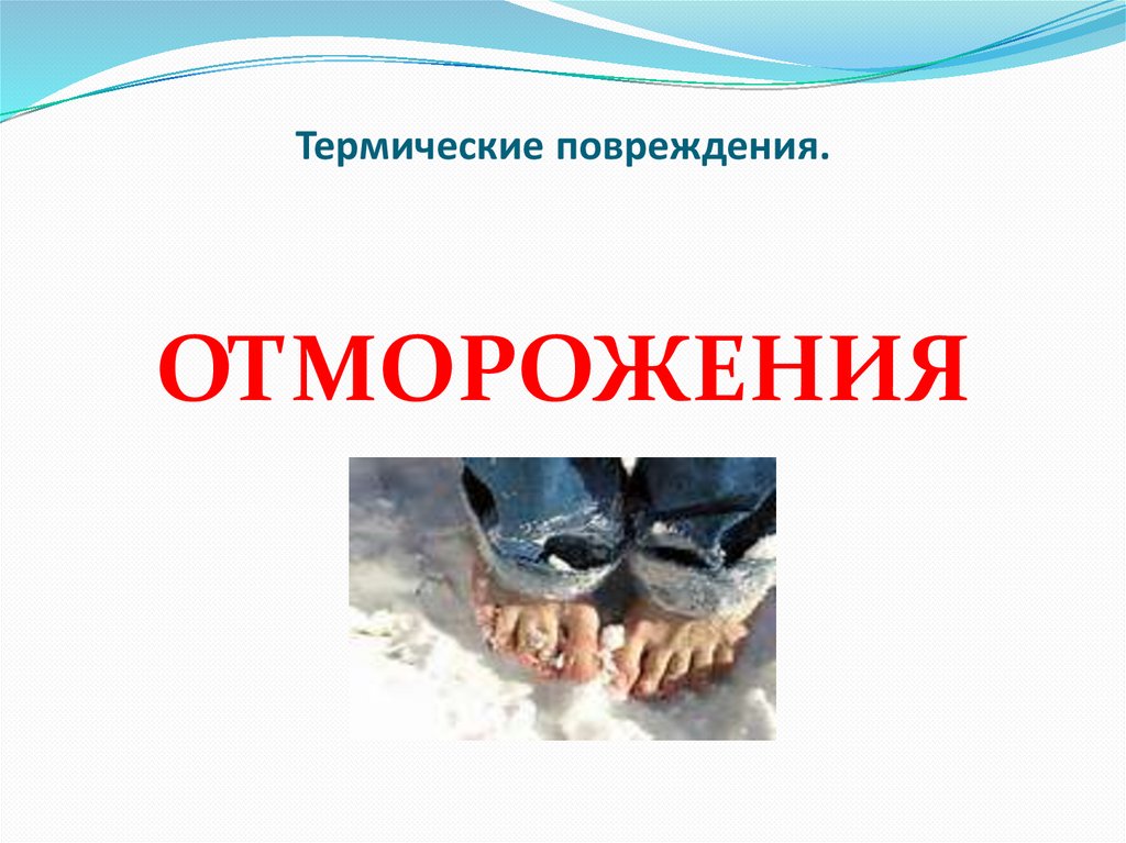 Термические повреждения.