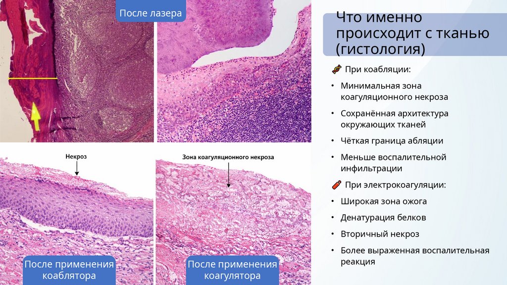 Что именно происходит с тканью (гистология)