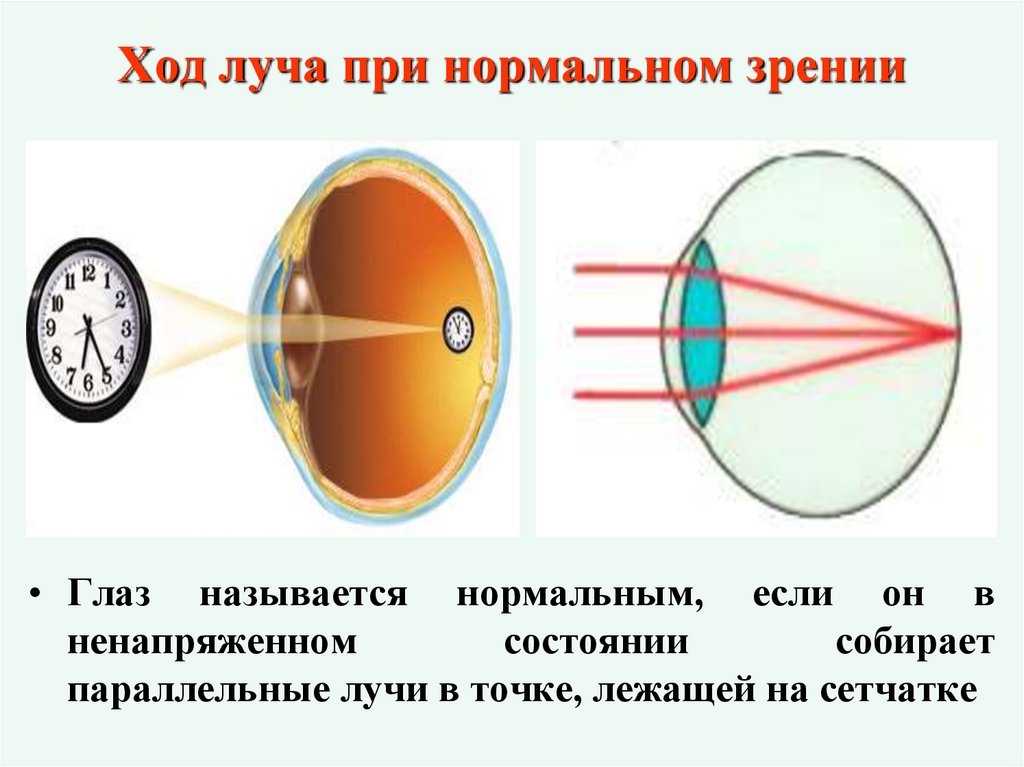 Ход луча при нормальном зрении