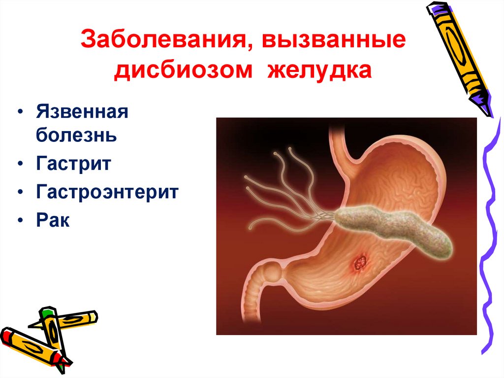 Заболевания, вызванные дисбиозом желудка