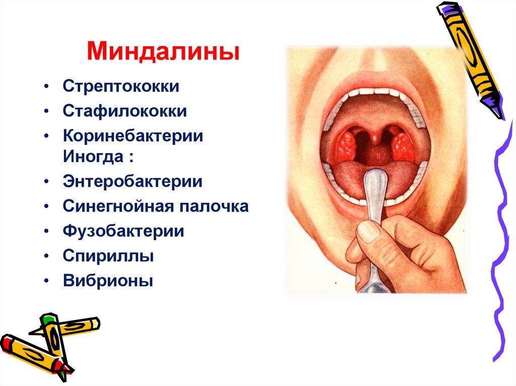 Миндалины