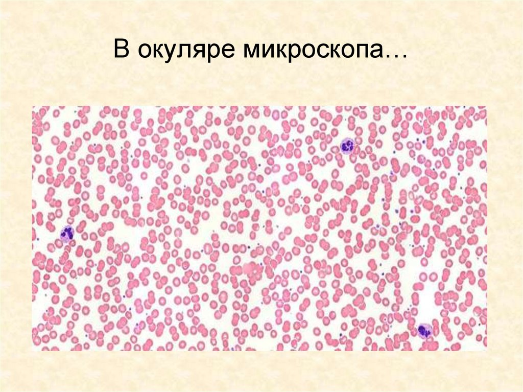 В окуляре микроскопа…