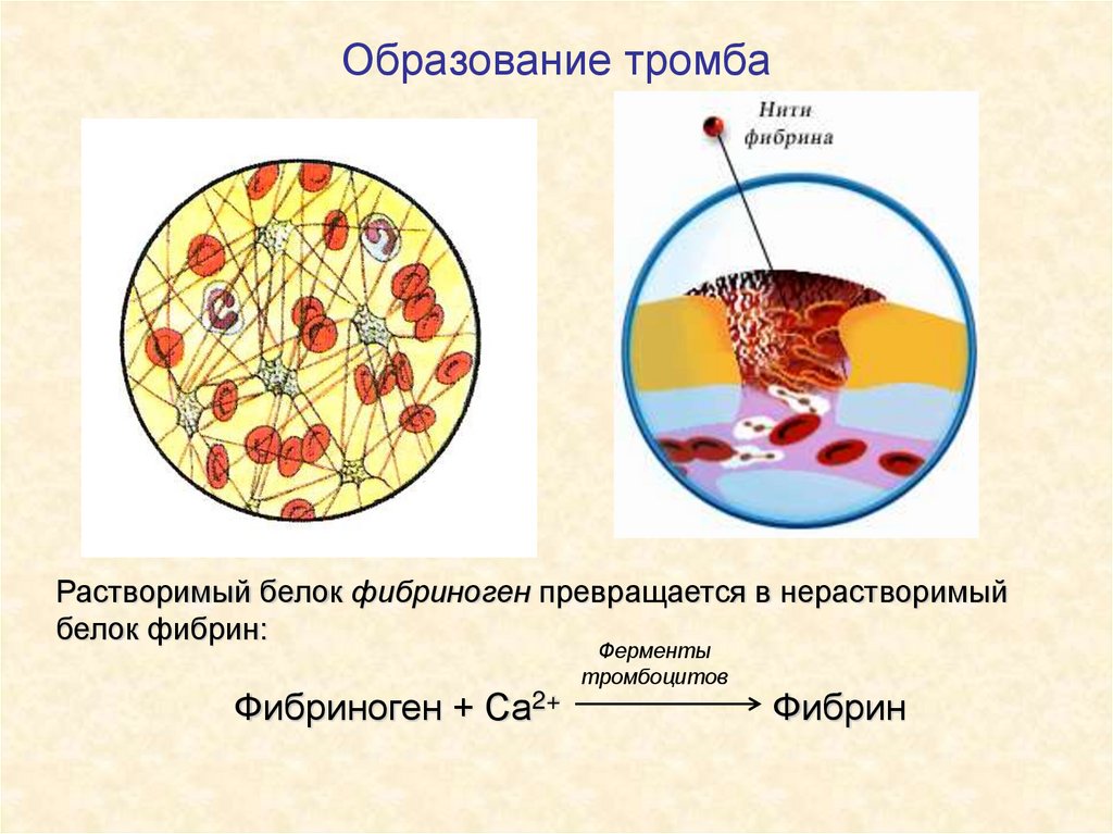 Образование тромба
