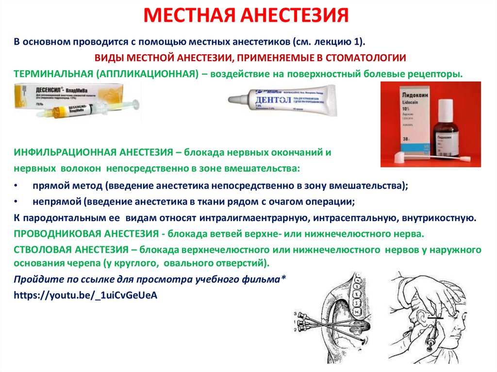 МЕСТНАЯ АНЕСТЕЗИЯ