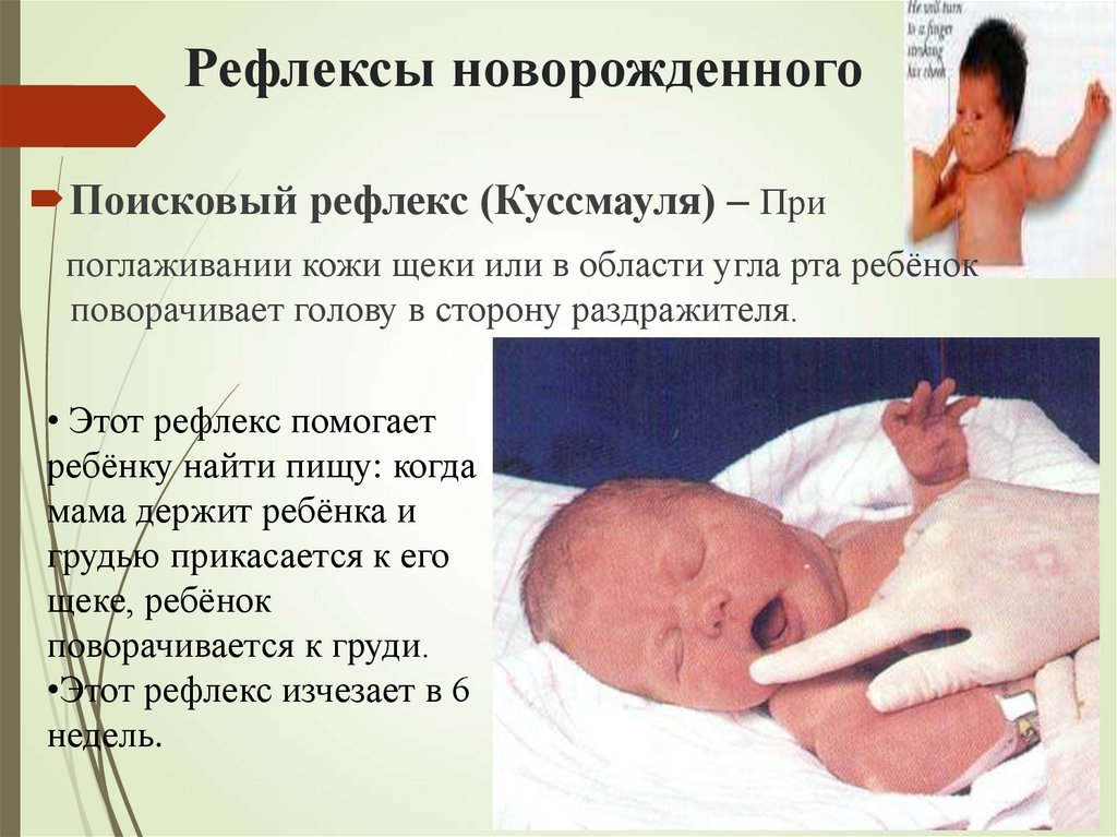 Рефлексы новорожденного