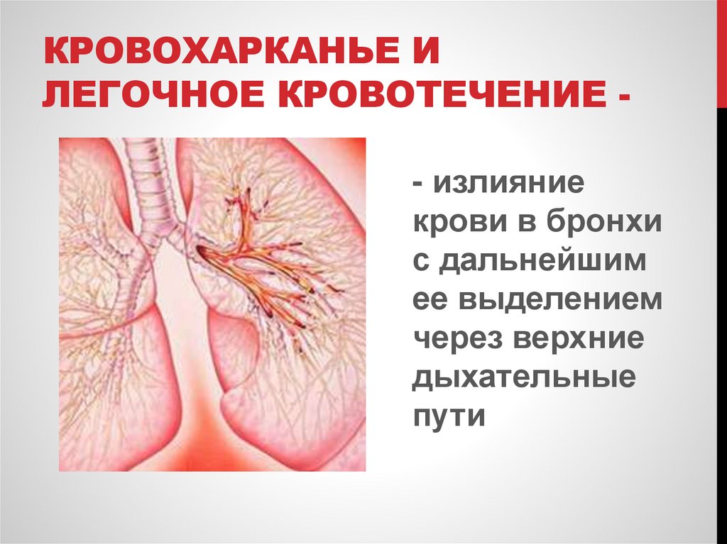 Кровохарканье и легочное кровотечение -