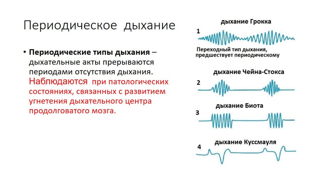 Периодическое дыхание