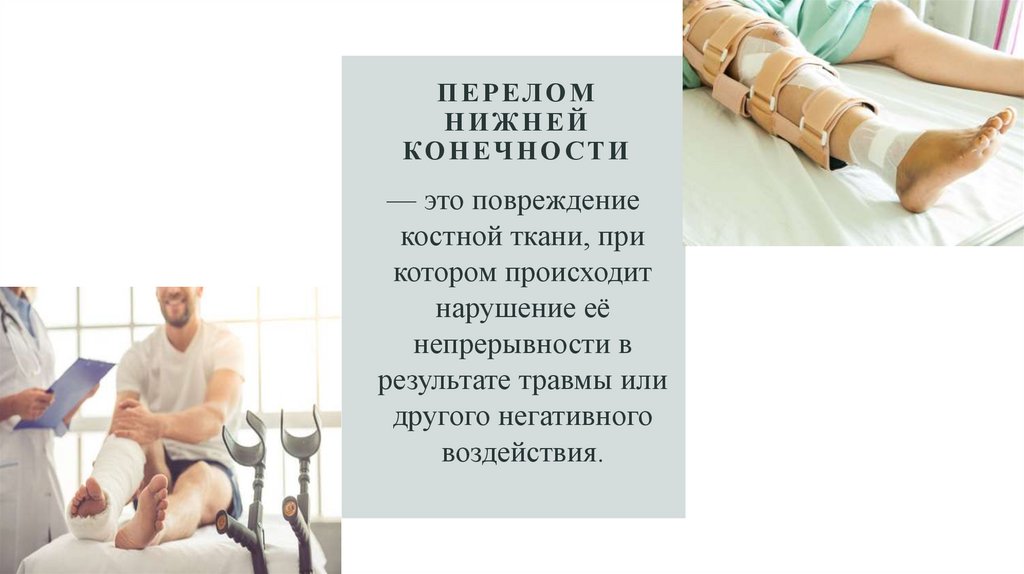 ПЕРЕЛОМ НИЖНЕЙ КОНЕЧНОСТИ