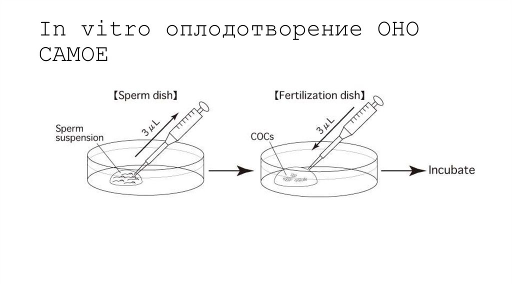 In vitro оплодотворение ОНО САМОЕ
