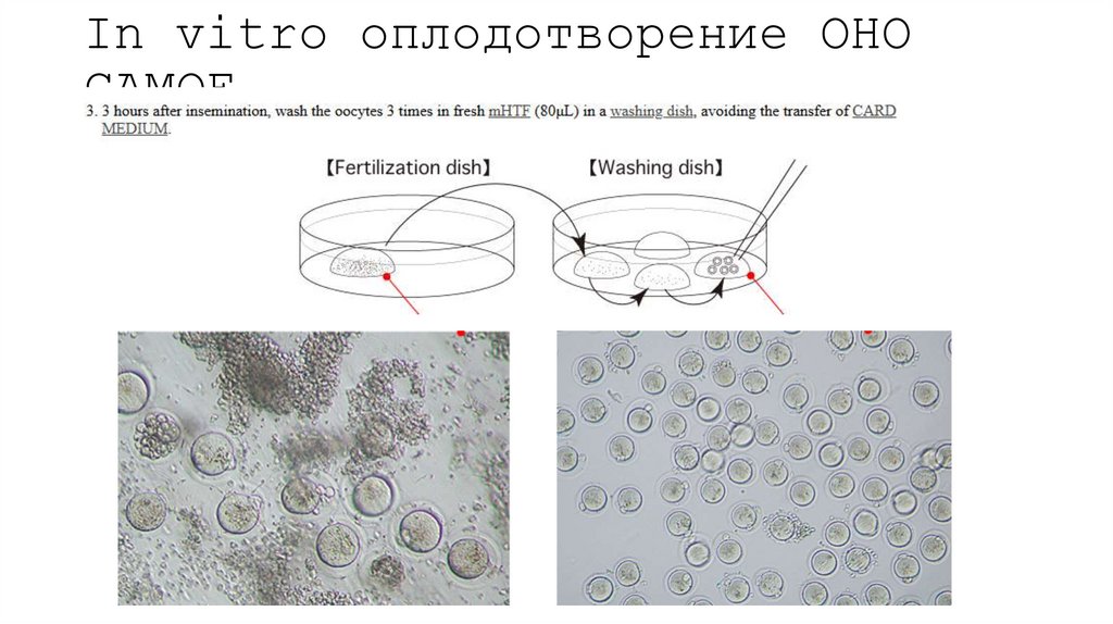 In vitro оплодотворение ОНО САМОЕ
