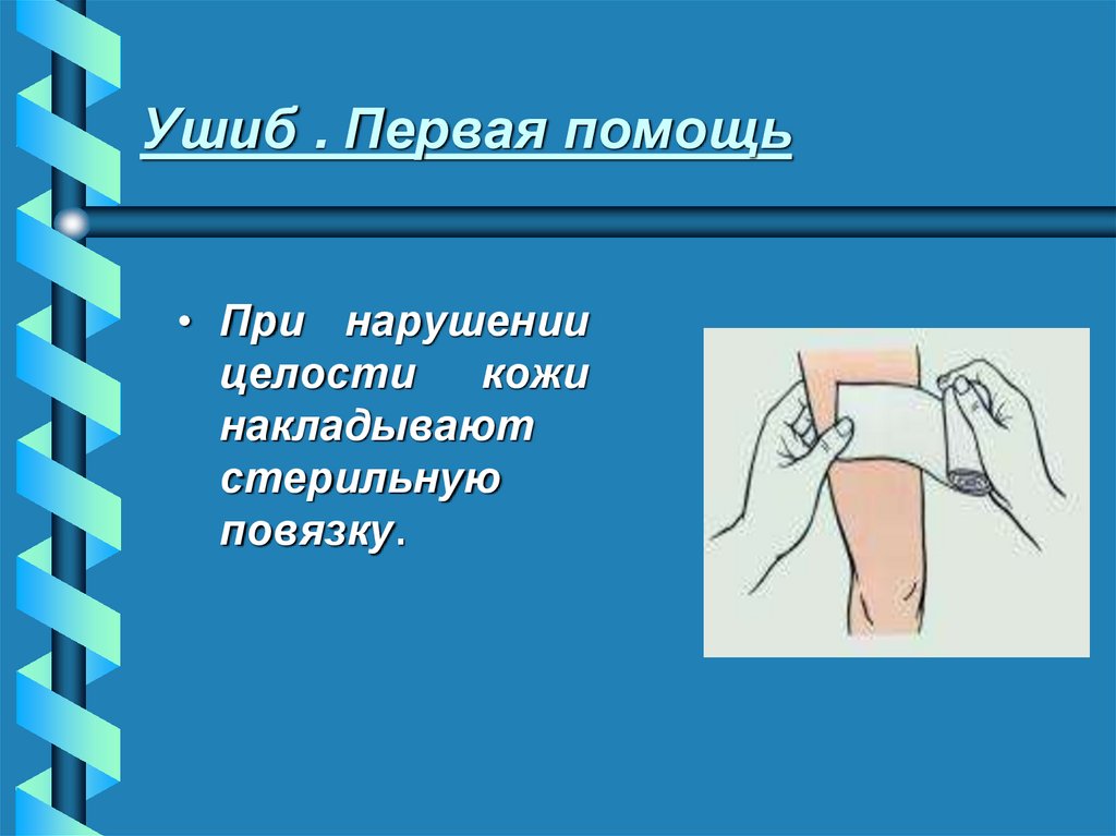 Ушиб . Первая помощь