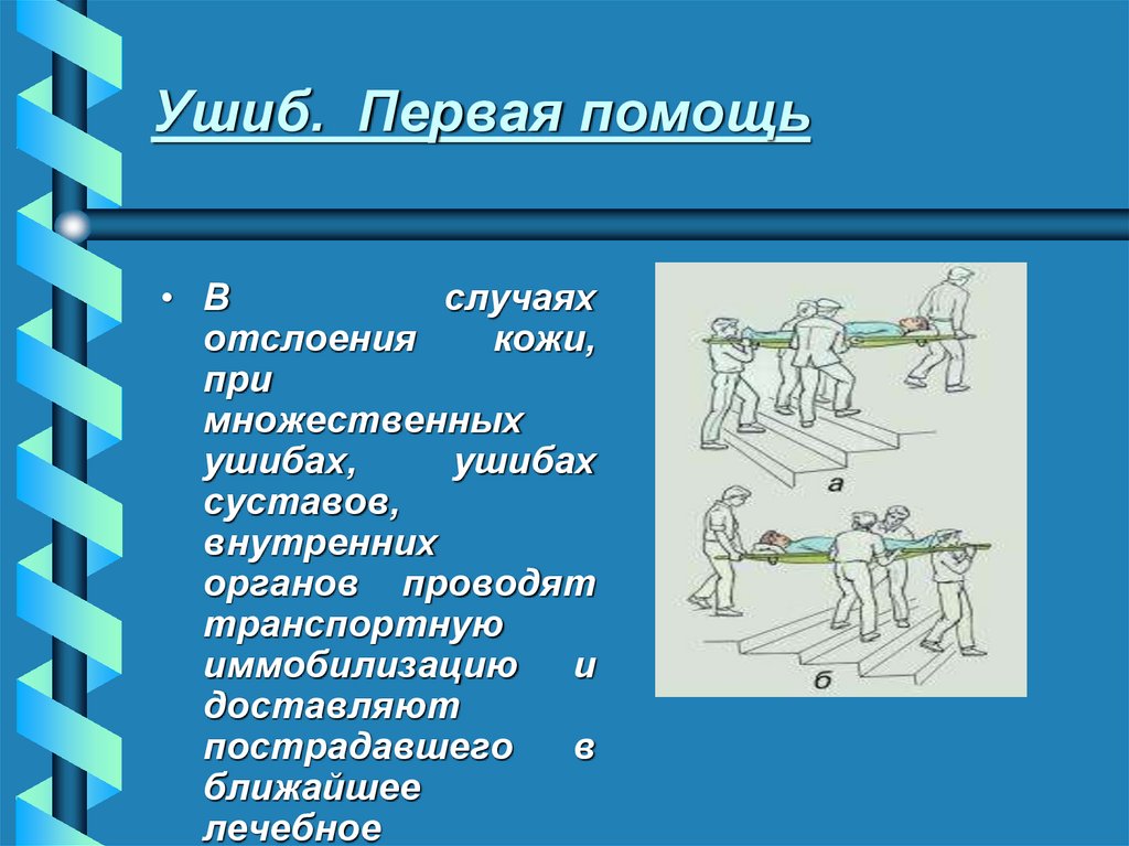 Ушиб. Первая помощь