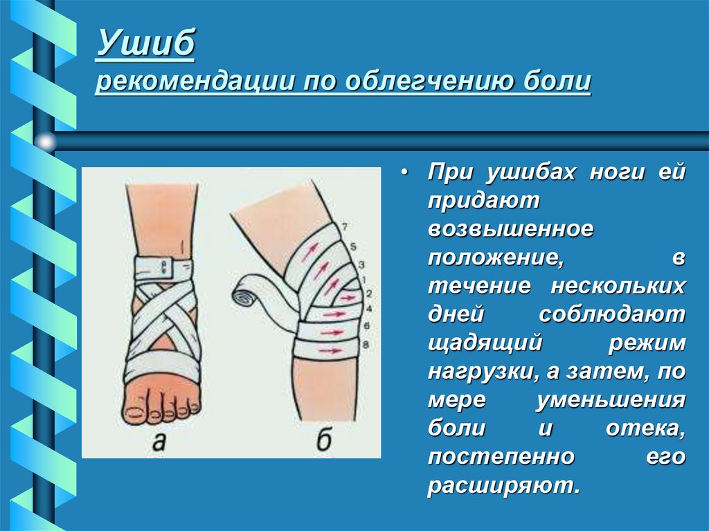 Ушиб рекомендации по облегчению боли