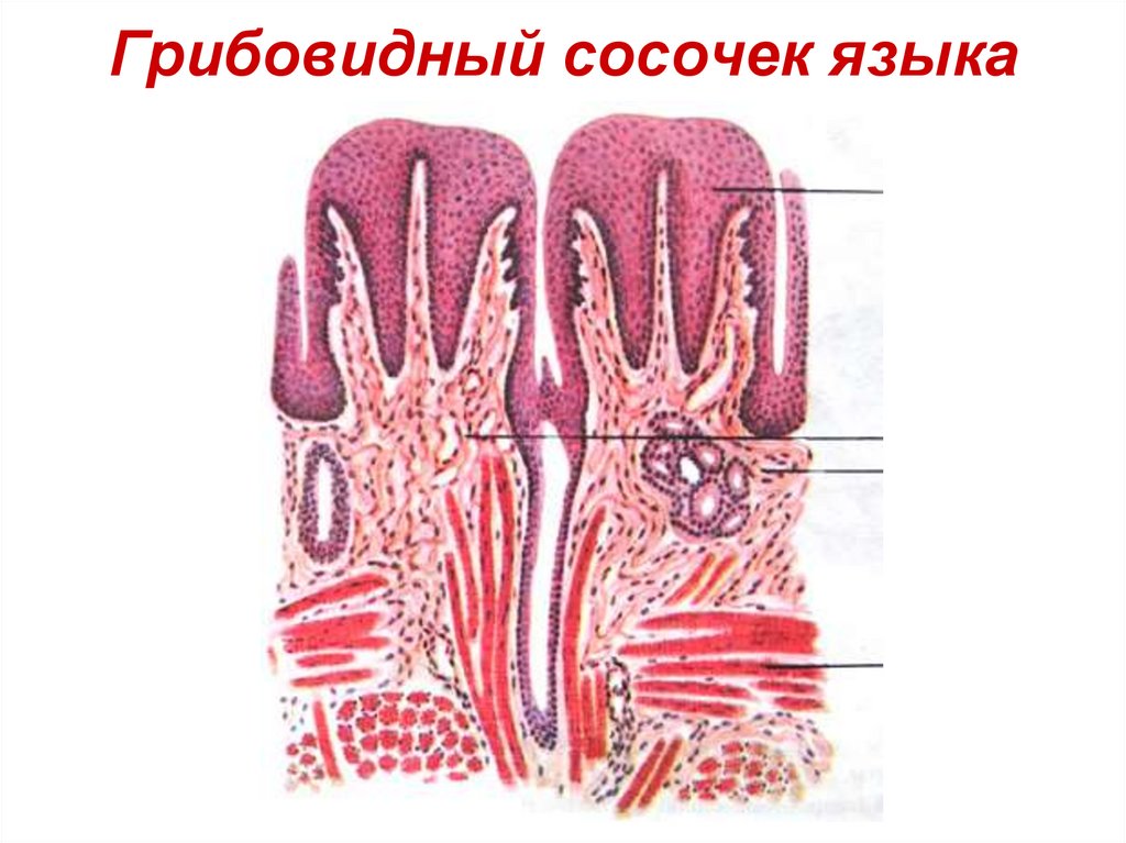 Грибовидный сосочек языка