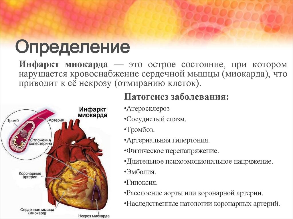 Определение