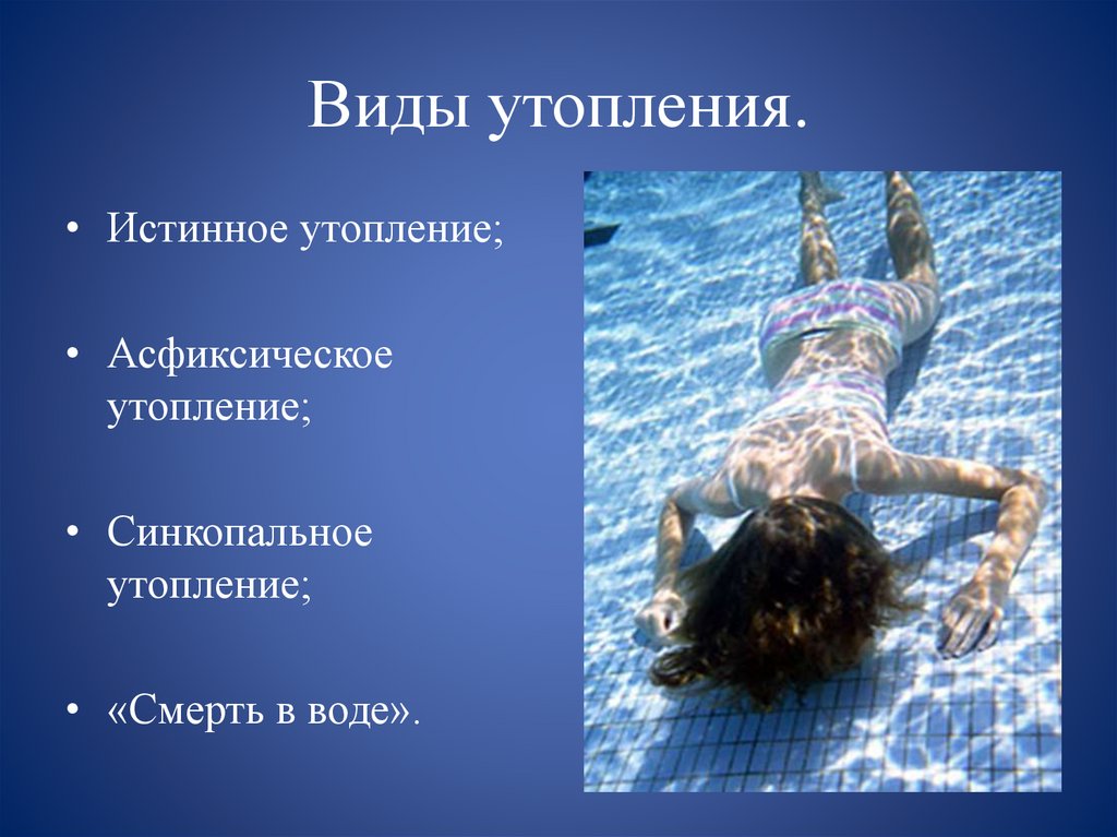 Виды утопления.