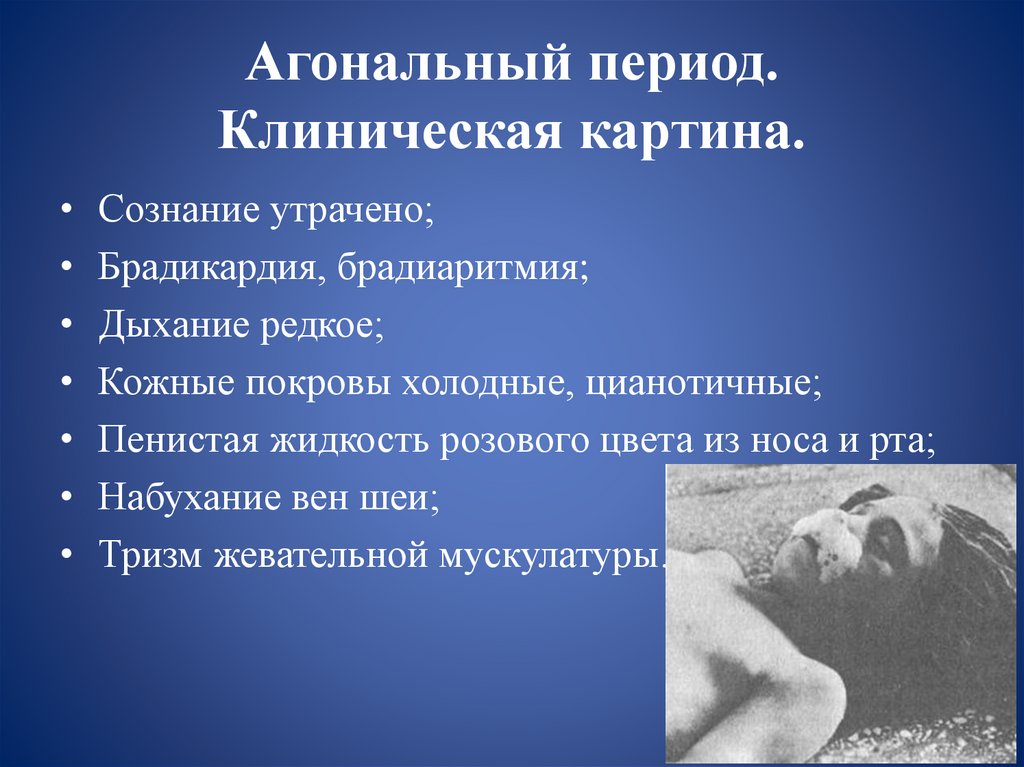 Агональный период. Клиническая картина.