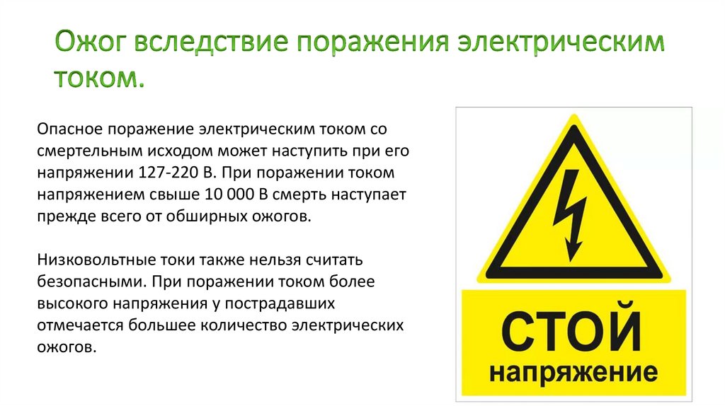 Ожог вследствие поражения электрическим током.