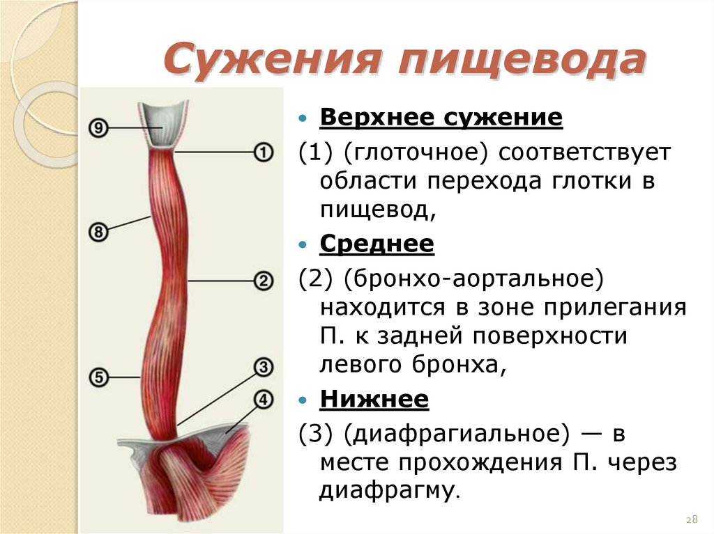 Сужения пищевода
