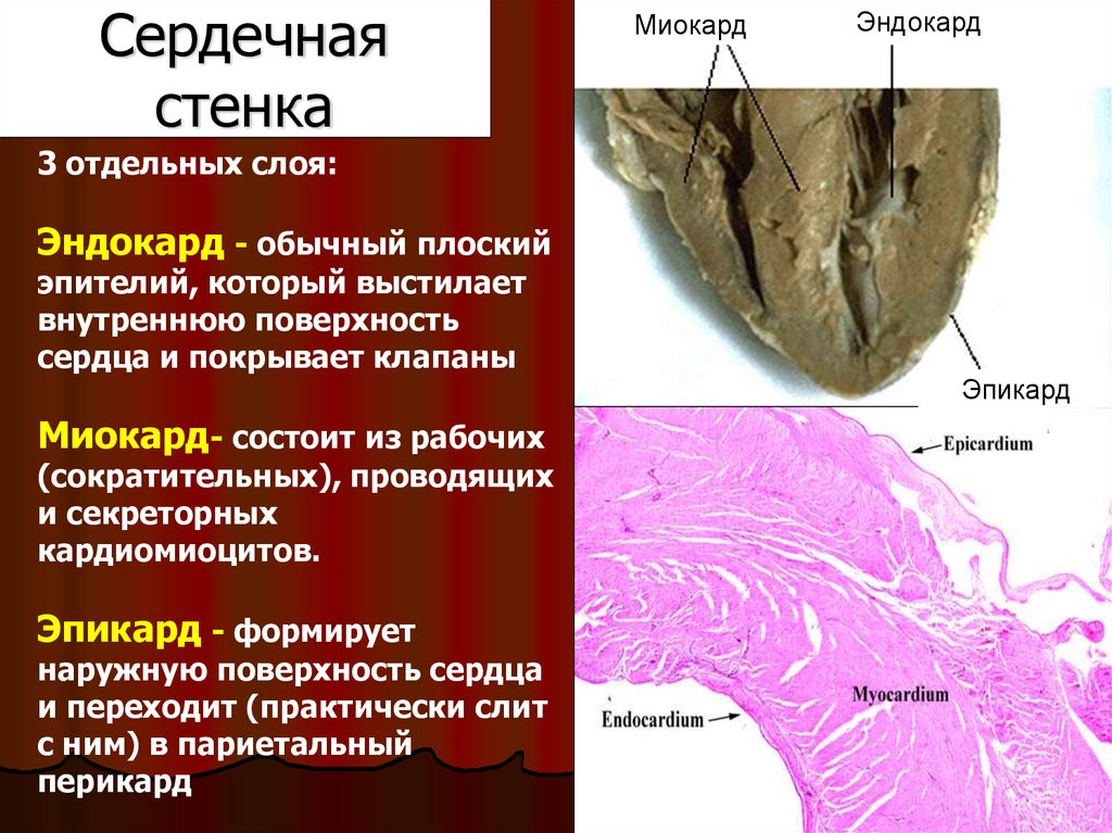 Сердечная стенка