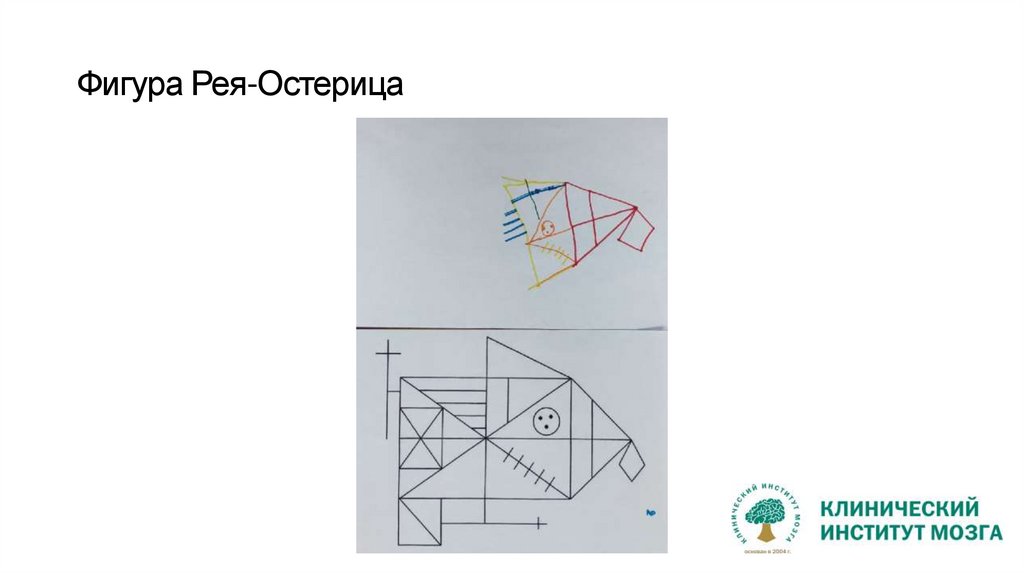 Фигура Рея-Остерица