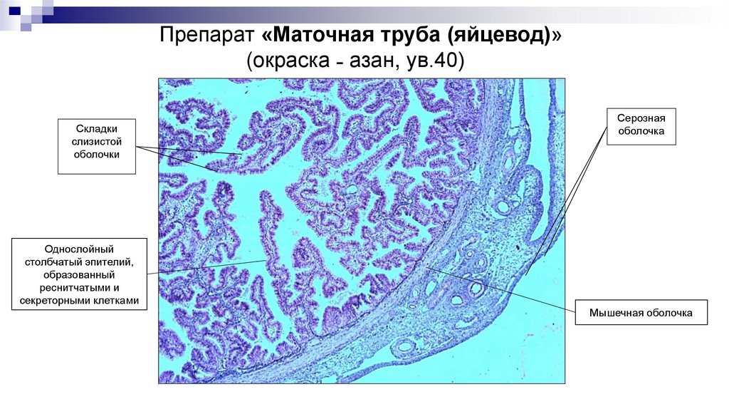 Препарат «Маточная труба (яйцевод)» (окраска ˗ азан, ув.40)