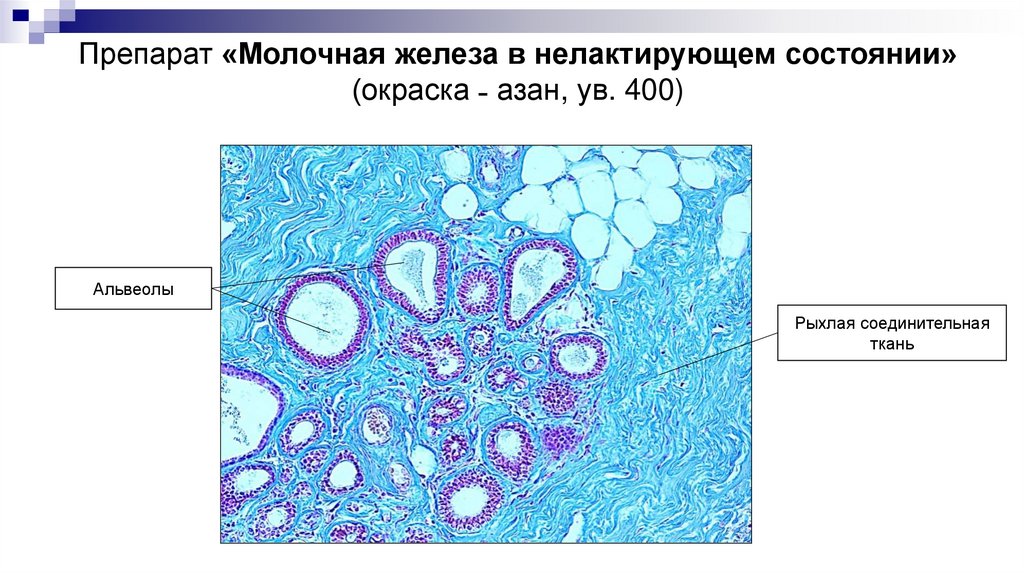 Препарат «Молочная железа в нелактирующем состоянии» (окраска ˗ азан, ув. 400)