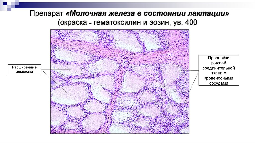 Препарат «Молочная железа в состоянии лактации» (окраска ˗ гематоксилин и эозин, ув. 400