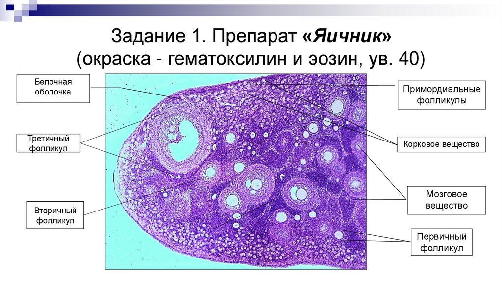 Задание 1. Препарат «Яичник» (окраска - гематоксилин и эозин, ув. 40)